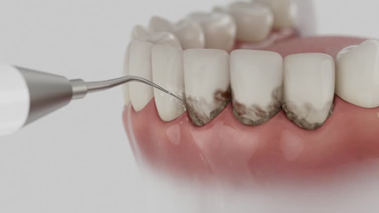 Trusted Root Canal Treatment service in Concordia, NJ - Dentist Open Now
